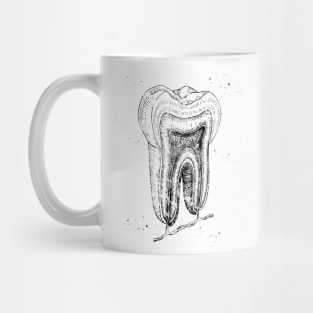 Human tooth structure Mug